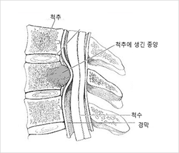 척추 뼈