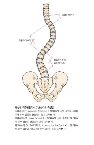 척추 뼈