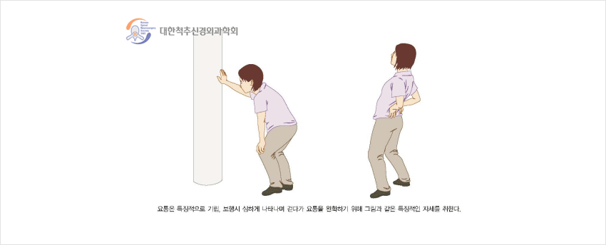 척추 뼈