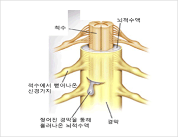 척추 뼈