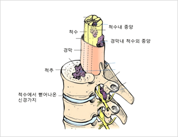 척추 뼈